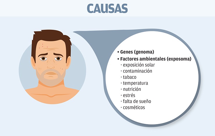Liposomial