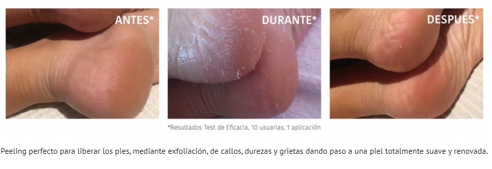 Peeling de ácido glicólico e meias esfoliantes